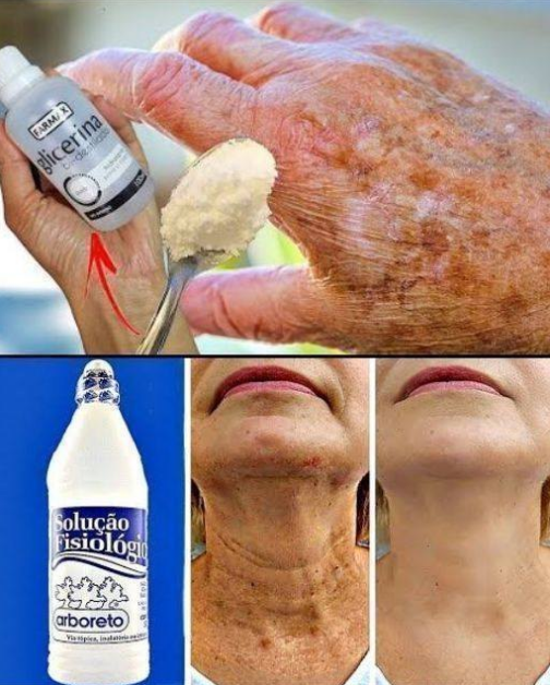 Como clarear manchas na pele com segurança: o que realmente funciona (e o que evitar)