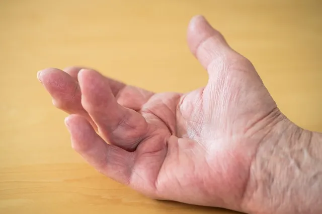 Suas Mãos Podem Revelar Problemas de Saúde? Veja 7 Sinais